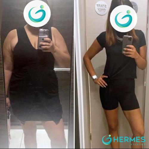 Before after photos of our patients 3